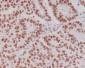 Anti-Phospho-Creb (S133) CREB1 Rabbit Monoclonal Antibody